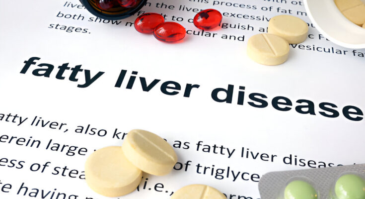 Natural Ways to Reduce the Risk of Fatty Liver Disease: Exploring Fruits, Tea, and Other Superfoods